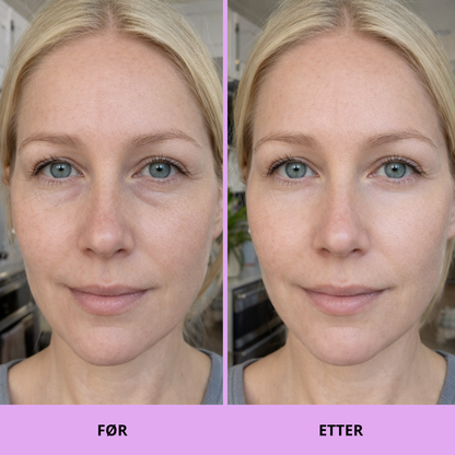 K-Beauty Peptide & Caffeine Eye Pads – Reduserer hevelser og gir fuktighet på 10 minutter