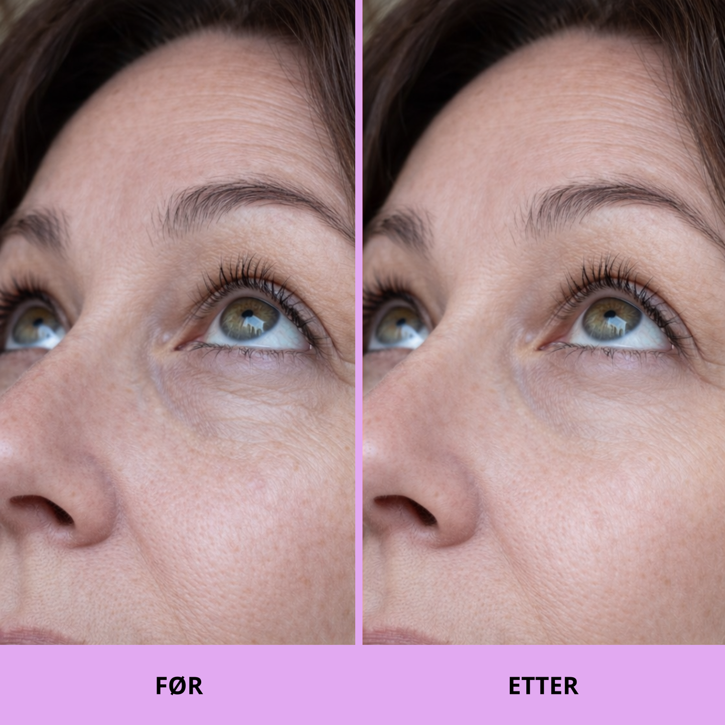 K-Beauty Peptide & Caffeine Eye Pads – Reduserer hevelser og gir fuktighet på 10 minutter