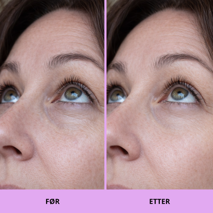 K-Beauty Peptide & Caffeine Eye Pads – Reduserer hevelser og gir fuktighet på 10 minutter